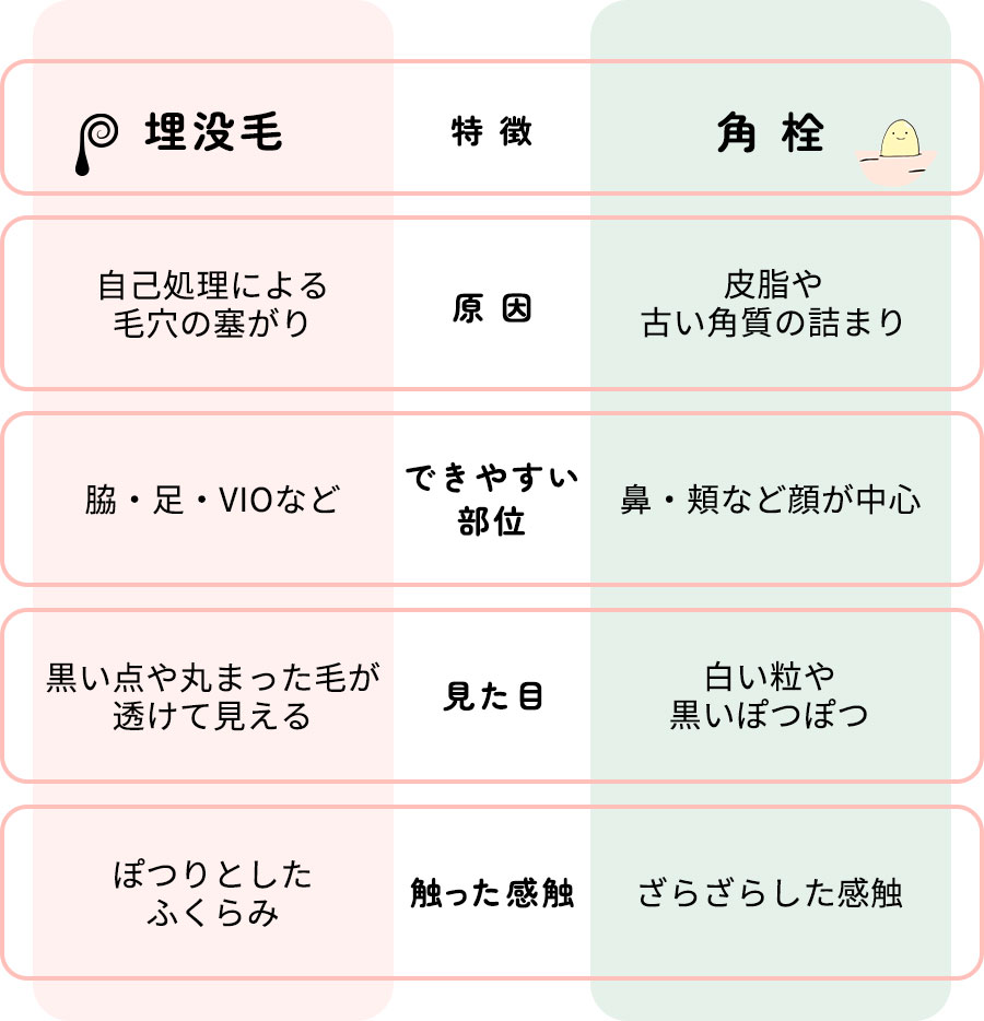 埋没毛と角栓の違い比較表