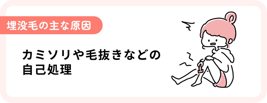 埋没毛の原因はカミソリなどの自己処理