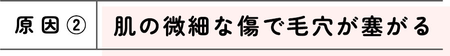 原因2: 肌の微細な傷で毛穴が塞がる