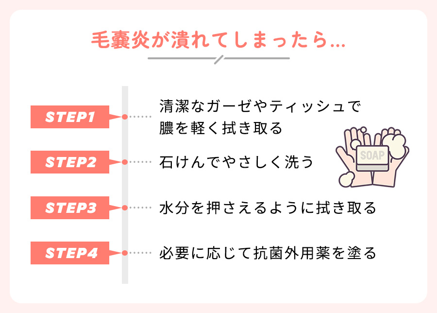 毛嚢炎が潰れてしまった時の対処法まとめ