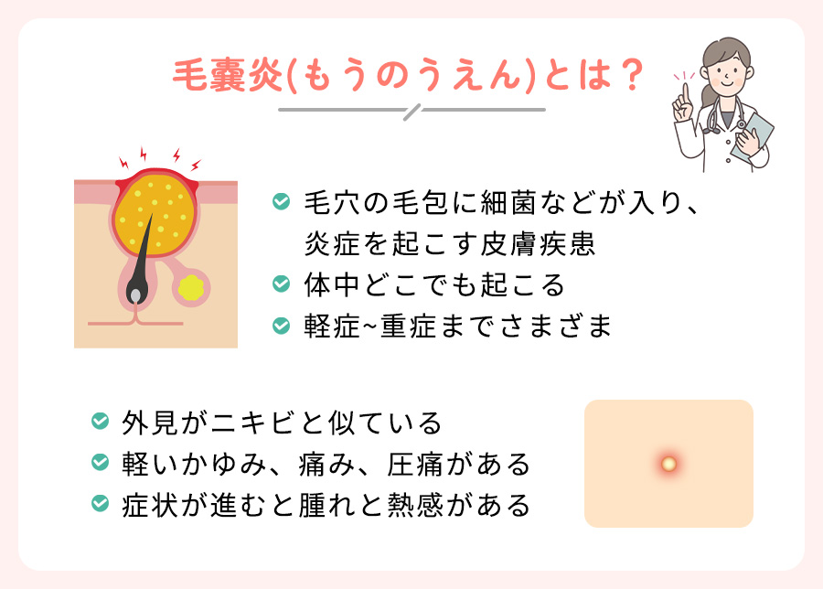 毛嚢炎の特徴まとめ