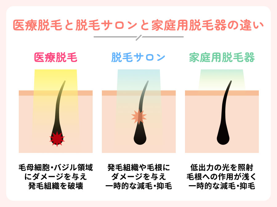 医療脱毛と美容脱毛の違い