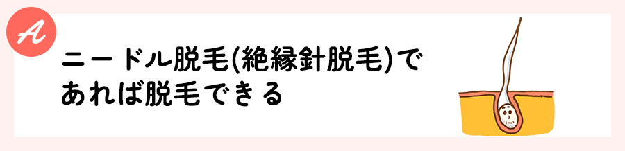 ニードル脱毛(絶縁針脱毛)であれば脱毛できる
